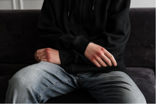 3 Ways Bipolar Disorder Manifests in Teenagers